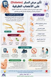 تأثير مرض السكر (Diabetes) على الأعصاب الطرفية وطرق الوقاية والعناية بالقدمين